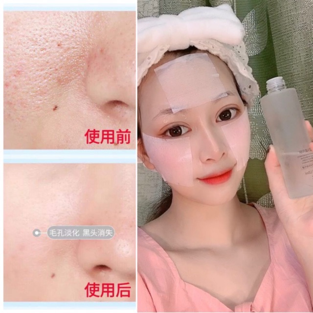 Nước thần làm đẹp da Beauty skincare