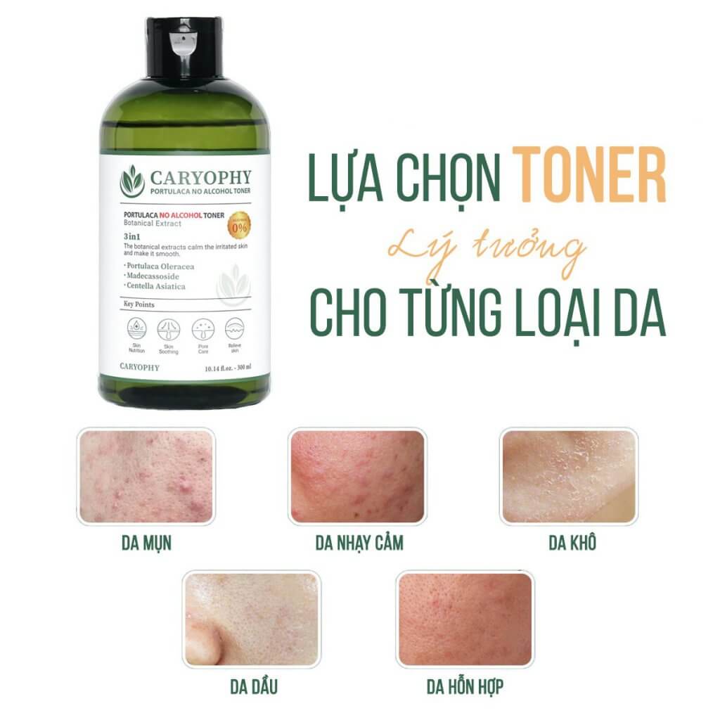 Nước Hoa Hồng Giảm Mụn Caryophy Portulaca Toner 300ml Mẫu Mới