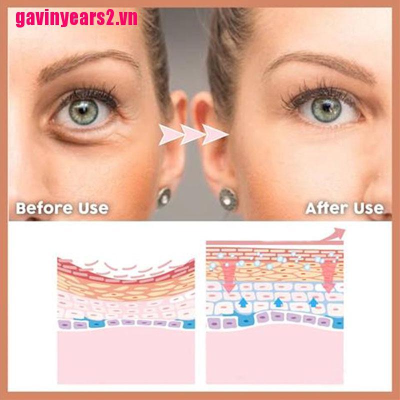 (Hàng Mới Về) Kem Dưỡng Da Mắt Gav2 2