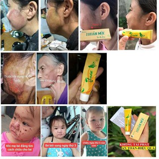 Kem bôi da Thuần khắc tinh của da Mộc