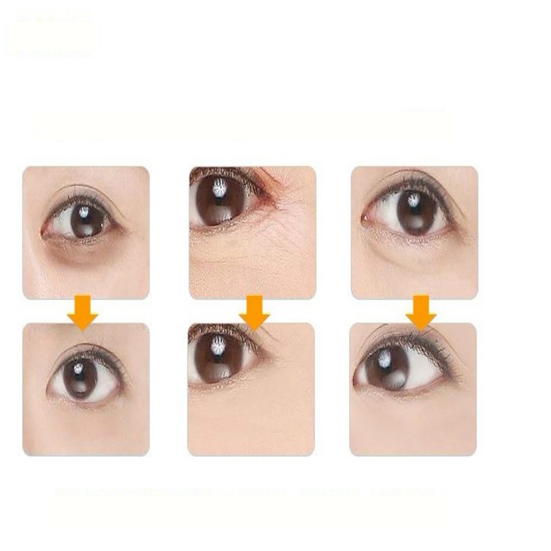 Cặp mặt nạ mắt collagen vàng giảm bọng mắt nếp nhăn chống lão hóa | BigBuy360 - bigbuy360.vn