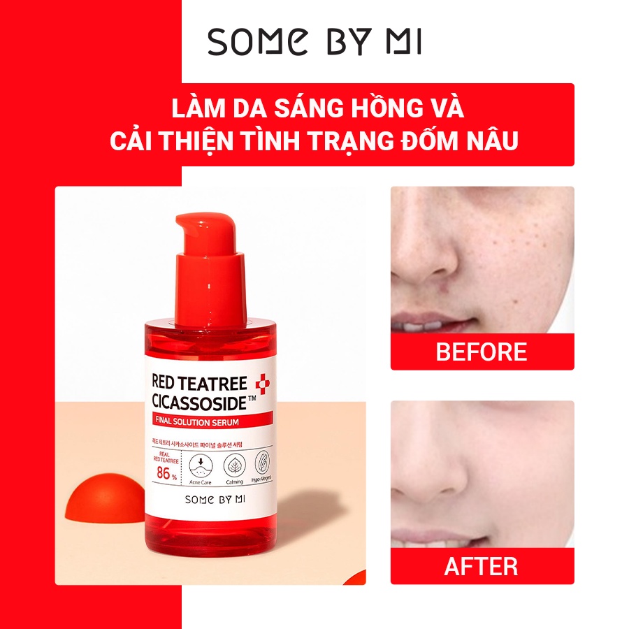 Tinh Chất Some By Mi Giảm Mụn Cho Da Nhạy Cảm Some By Mi Red Teatree Cicassoside Final 50ml