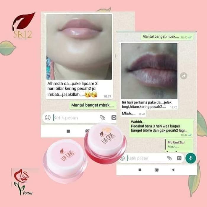 (Hàng Mới Về) Son Dưỡng Môi Làm Sáng Màu Môi Sr12 Màu Sắc | BigBuy360 - bigbuy360.vn