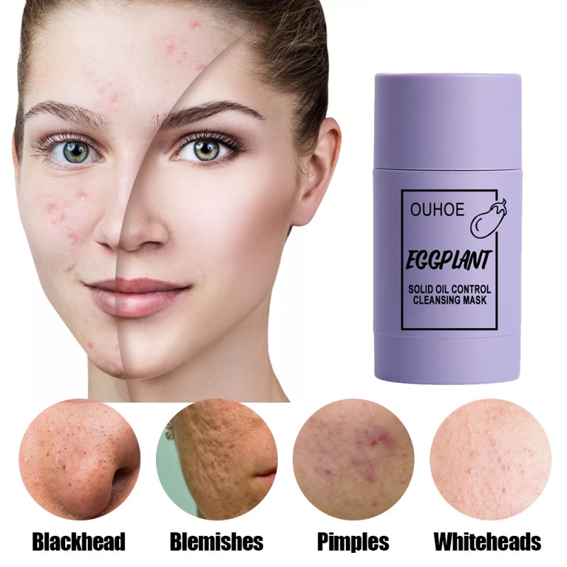 (Hàng Mới Về)Mặt Nạ Bùn Trà Xanh Kiềm Dầu Dưỡng Ẩm Loại Bỏ Mụn Đầu Đen Se Khít Lỗ Chân Lông Hiệu Quả UN | BigBuy360 - bigbuy360.vn