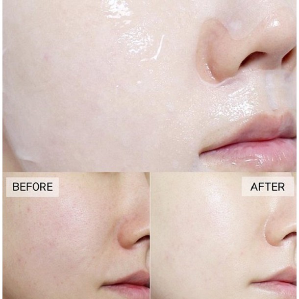 Hộp 10 Mặt nạ giấy dưỡng da cấp ẩm giúp da mềm mượt căng bóng BNBG Vita Genic Hydrating Jelly Mask (Vitamin E) 30ml x 10