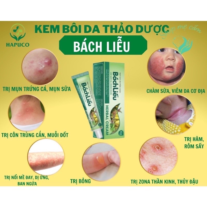 Kem Bôi Da Bách Liễu