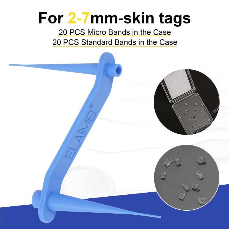 Thiết Bị Loại Bỏ Mụn Thịt Dư Trên Da Tiện Dụng