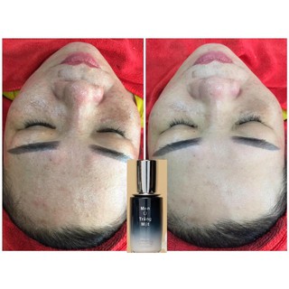 Men Ủ Trắng Mặt Dr Cell