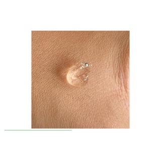 Gel giảm mụn thâm Megaduo 15gr