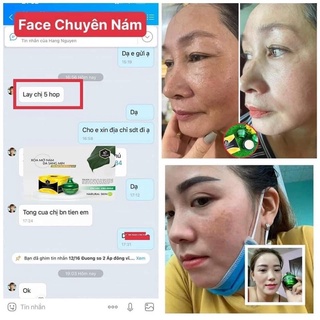 COMBO NÁM HUỲNH ĐỖ( sữa rửa mặt+serum 3w+ kem chuyên nám)