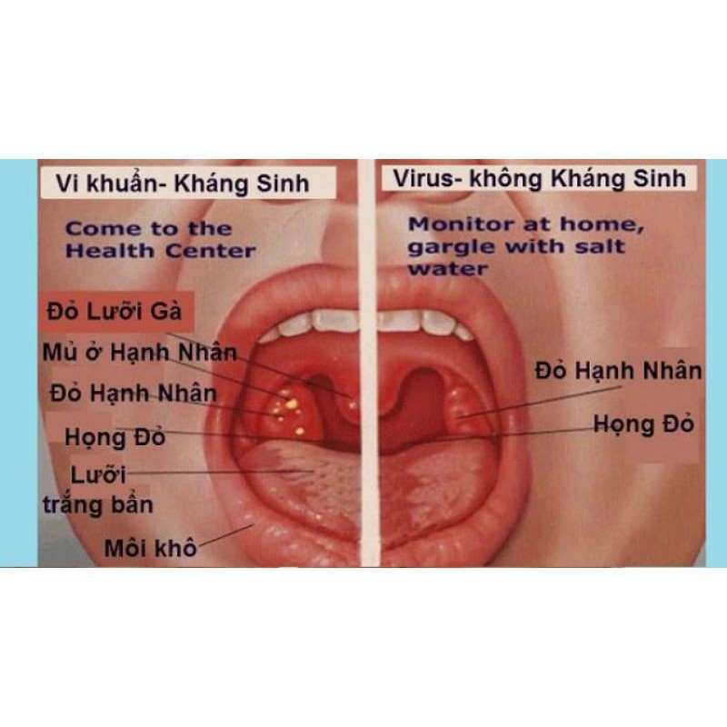 Ông cụ làng nghè - Ho, viêm amidan, viêm họng hạt