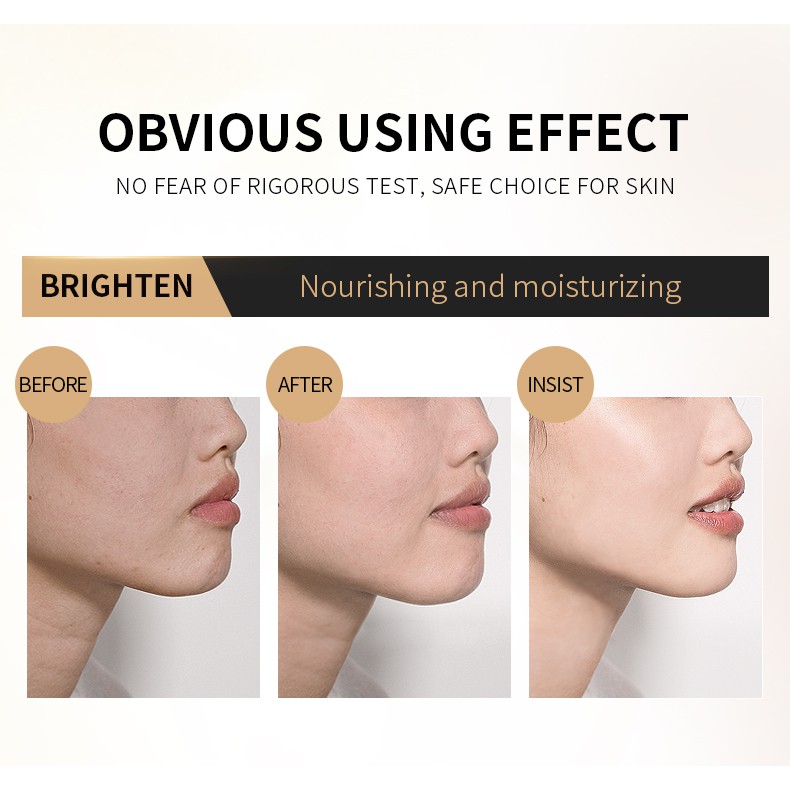 Tinh Chất Fenyi Chiết Xuất Ốc Sên Và Nhân Sâm Chống Lão Hóa Làm Săn Chắc Và Trẻ Hóa Da 30ml