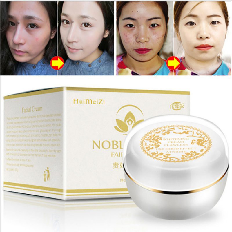 [Hàng mới về] Kem mặt xóa tàn nhang làm trắng mặt 30g | BigBuy360 - bigbuy360.vn