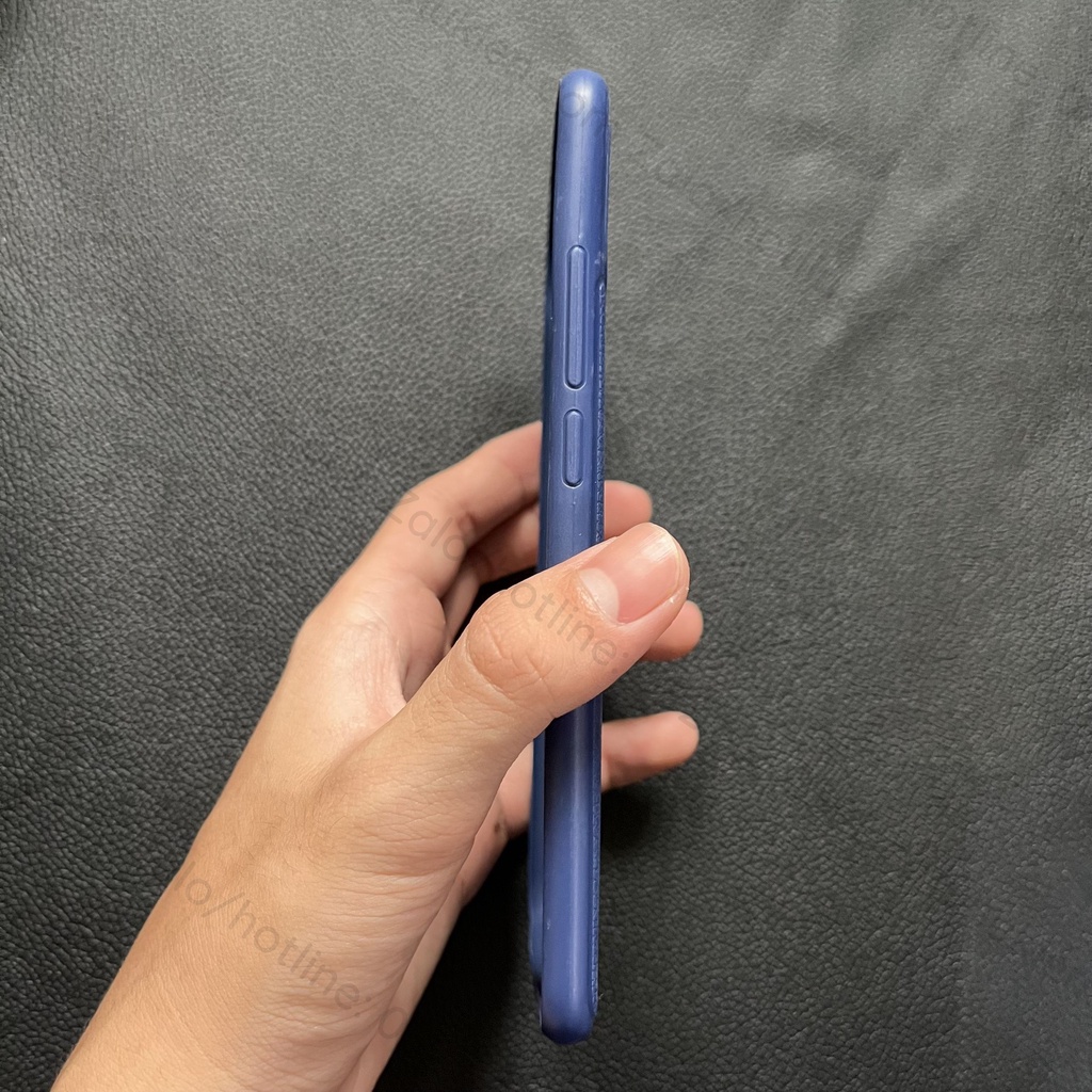 Ốp lưng Xiaomi Mi S2 dẻo vân giả da auto bền đẹp