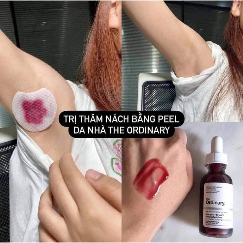 Tinh Chất Peel da The Ordinary AHA 30%+BHA 2% Peeling Solution