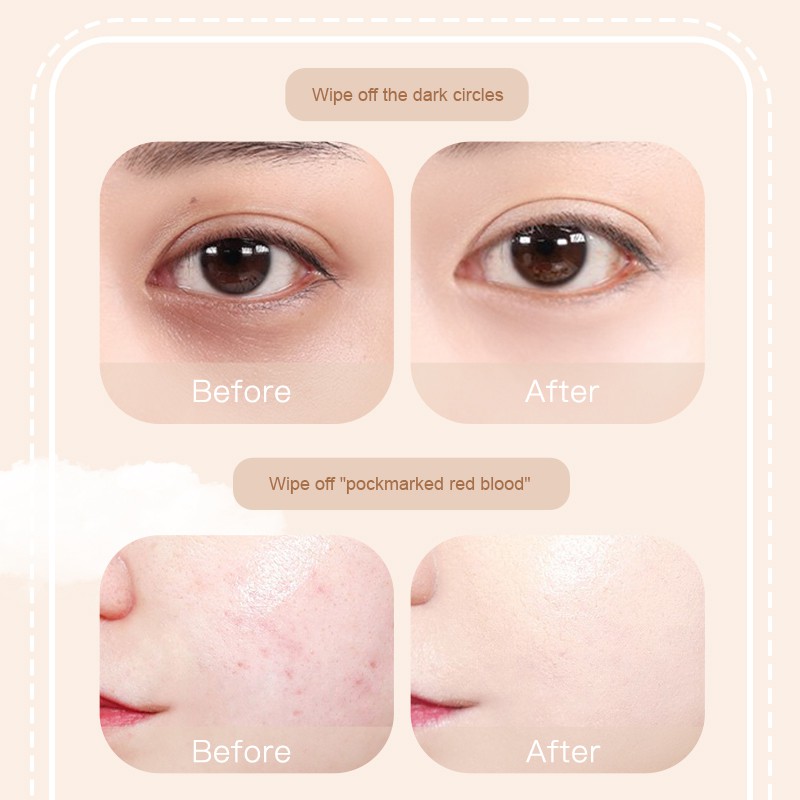 [Hàng mới về] Che khuyết điểm hai đầu Novo che phủ quầng thâm và tàn nhang | BigBuy360 - bigbuy360.vn