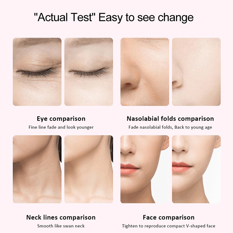 Máy Mát Xa Ion Giúp Trẻ Hóa Làn Da Làm Săn Chắc Da Chống Nếp Nhăn