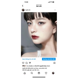 LENS xám đục K VÂN GIÃN NHẸ