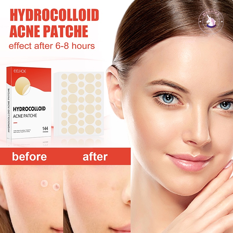 Miếng Dán Hấp Thụ Hydrocolloid Chăm Sóc Da Mặt Vô Hình