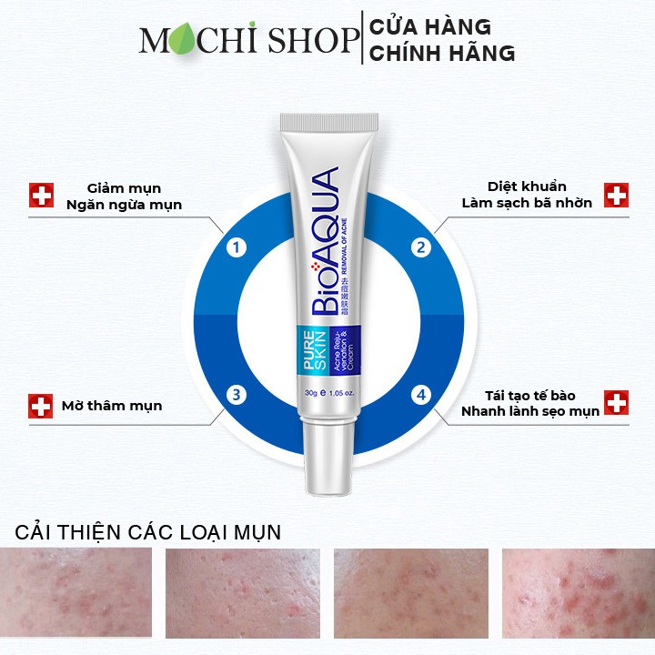Kem Giảm Mụn, Sạch Mụn, Ngừa Mụn Đầu Đen, Mụn Đỏ, Mụn Cám Acne Bioaqua Sạch Bã Nhờn, Dưỡng Ẩm Chính Hãng - MOCHI SHOP | BigBuy360 - bigbuy360.vn