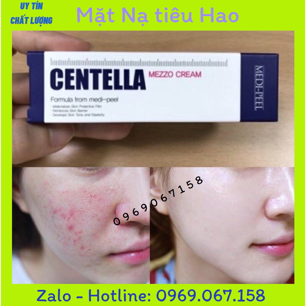 Kem ngừa mụn rau má Medi-Peel Centella Mezzo Cream - Medi Peel