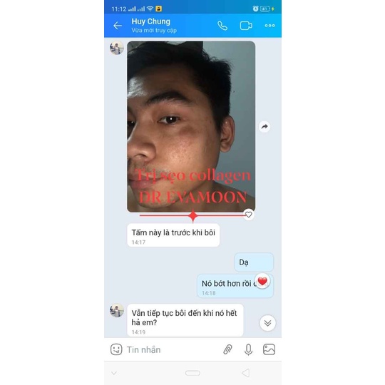 DR EVA cao sẹo collagen handmade