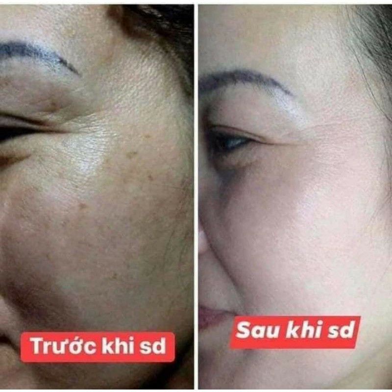Sữa Rửa Mặt Balla Luta Chính Hãng