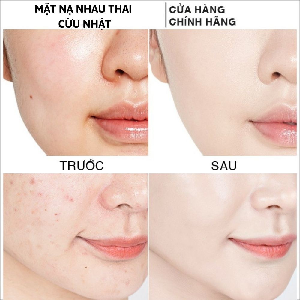 Set 10 miếng Mặt Nạ Nhau Thai Cừu Tế Bào Gốc Nhật Bản Stem Cell Rwine Beauty Trẻ Hóa, Trắng Da, Dưỡng Ẩm