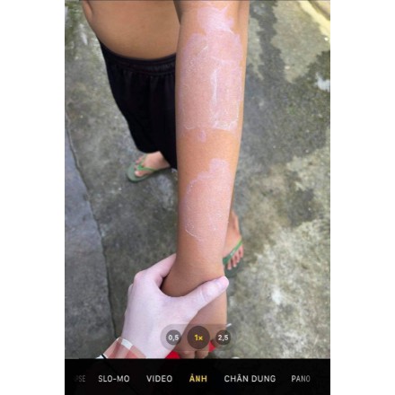 Tắm trắng toàn thân, body bật tông nhanh sau liệu trình đặc biệt không vàng lông, không châm chít, không khô da BBA- TTM | BigBuy360 - bigbuy360.vn