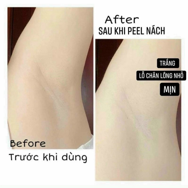 💥💥 𝐁𝐎̣̂ 𝐏𝐄𝐄𝐋 𝐍𝐀́𝐂𝐇 𝐇𝐎̂̀𝐍𝐆 𝐍𝐇𝐔̃ 𝐇𝐎𝐀 𝐓𝐫𝐚𝐧𝐠 𝐍𝐞𝐦𝐨 💥💥PEEL DA- PEEL NÁCH - PEEL TI