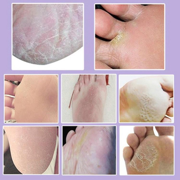 [Hàng mới về] Cặp mặt nạ chân thành phần sữa tre giấm