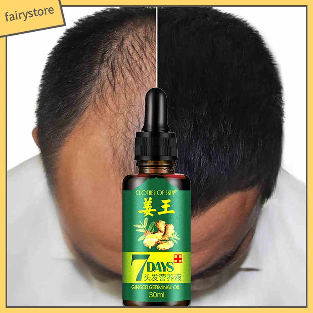 [Hàng mới về] Tinh dầu gừng kích thích mọc tóc an toàn hiệu quả trong 7 ngày