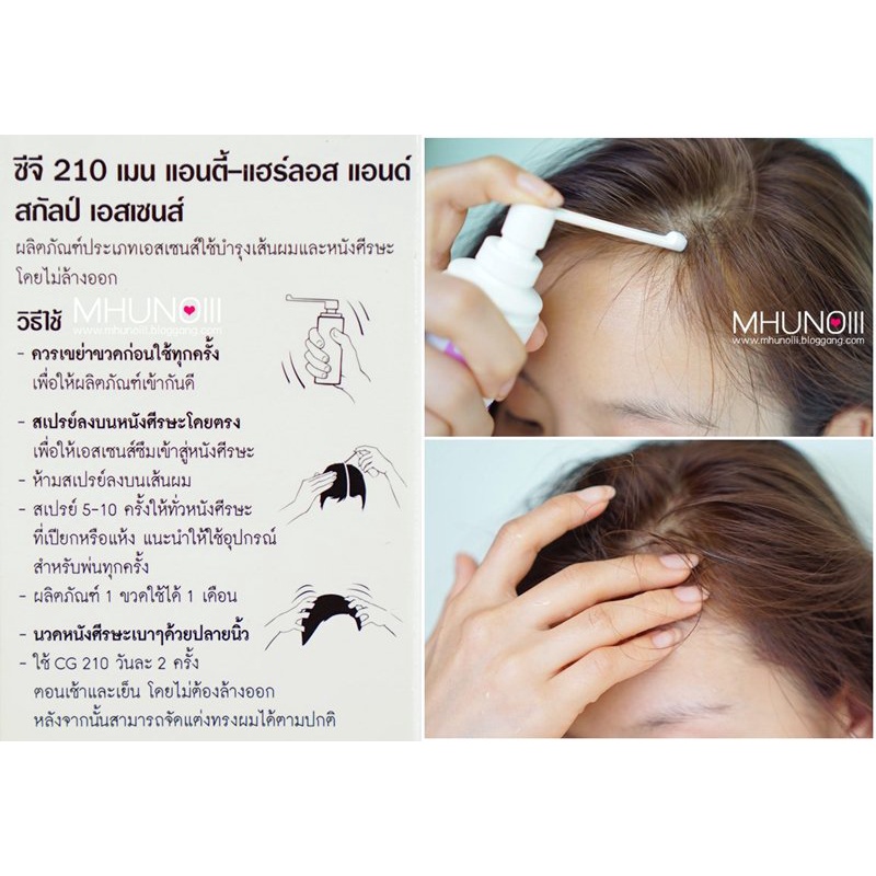 (ĐỌC KỸ MÔ TẢ) Tinh chất giảm rụng và kích mọc tóc cho Nam &amp; Nữ Abbott CG 210 Anti-Hair loss &amp; Scalp Essence 80ml (Pháp)