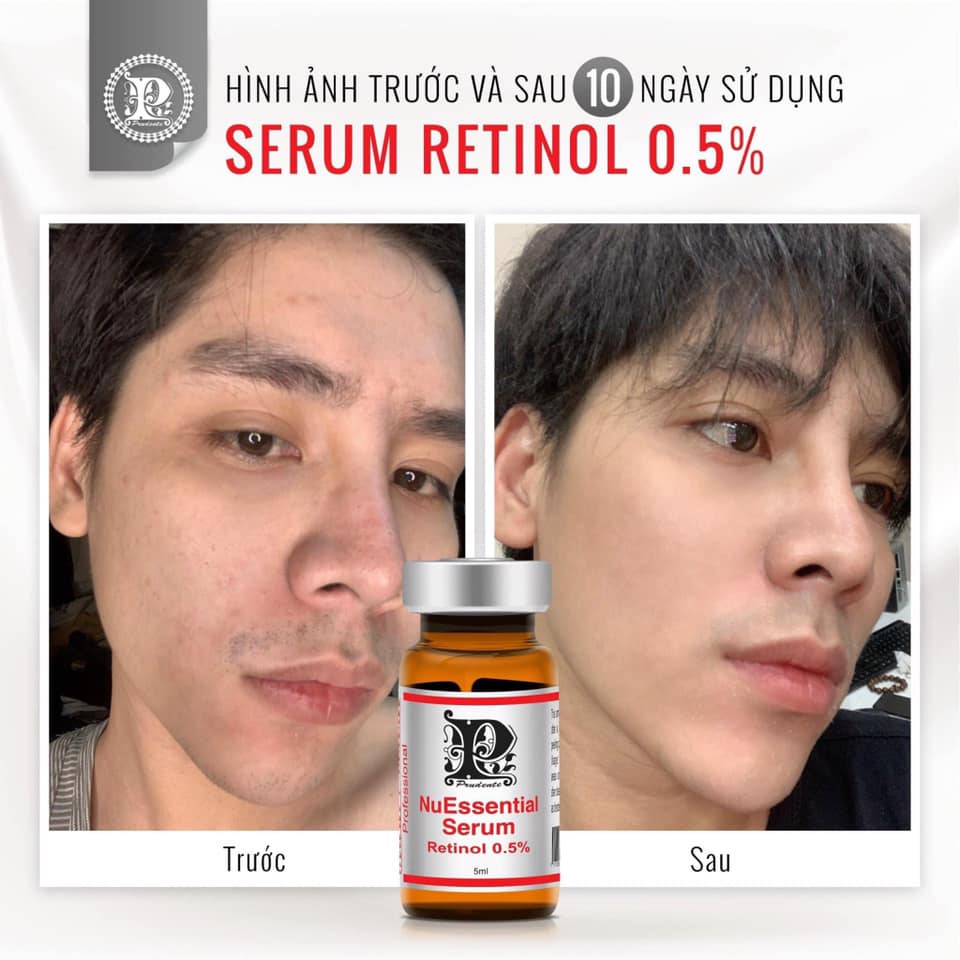 Tinh chất Serum RETINOL 0.5% MIBITI PRUDENTE 5ml