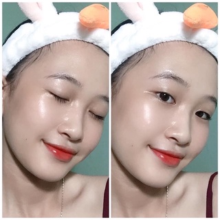 SERUM GIẢM MỤN THÂM VAURORA