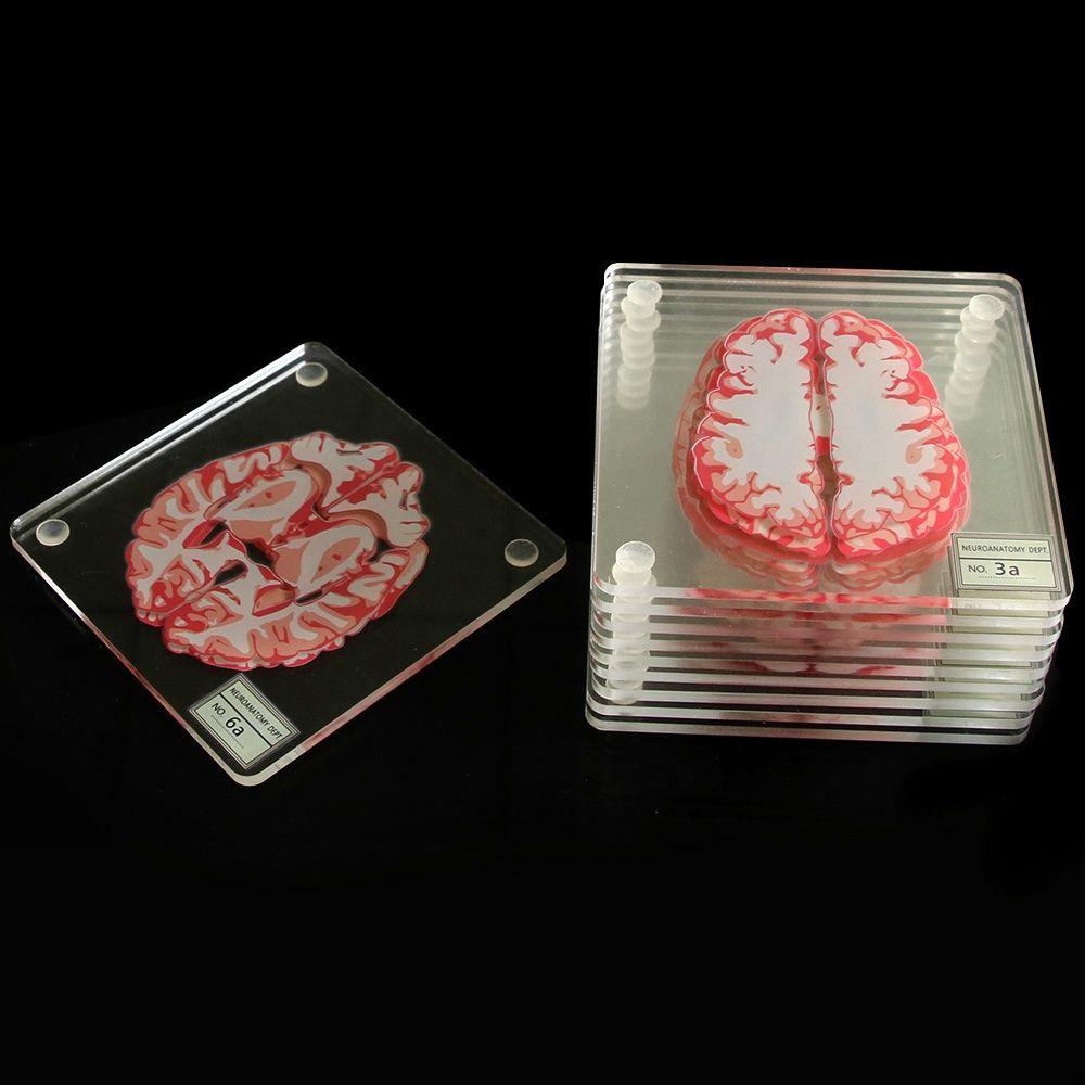Lloyd Bộ Đế Lót Cốc Bằng Acrylic Hình Lát Lát Nghệ Thuật Dành Cho Quán Bar / Nhà Ở