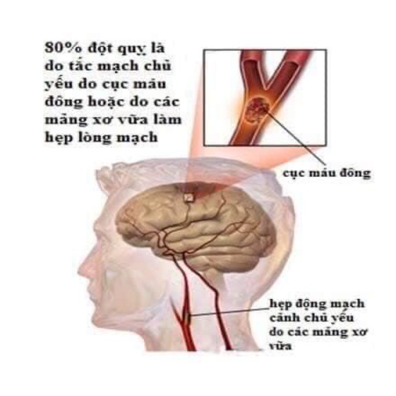 An cung ngưu hoàng hoàn Bio chính hãng, hộp 10 viên - Vũ hoàng thanh tâm phòng tai biến, đột khụy