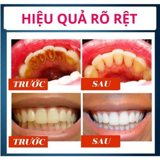 Kem đánh trắng răng baking soda  ( Hàng Nội Địa TQ )