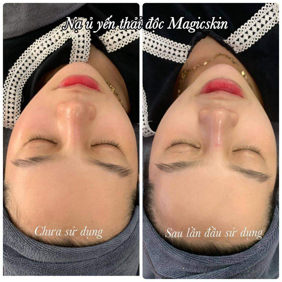 Ủ yến thải độc Magic skin_ thải chì_ hết mụn_ mờ nám_trắng da | BigBuy360 - bigbuy360.vn