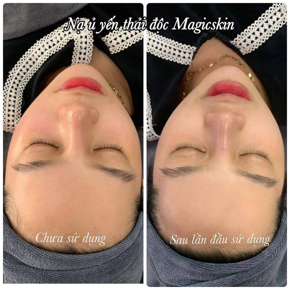 Ủ yến thải độc Magic skin_ thải chì_ hết mụn_ mờ nám_trắng da