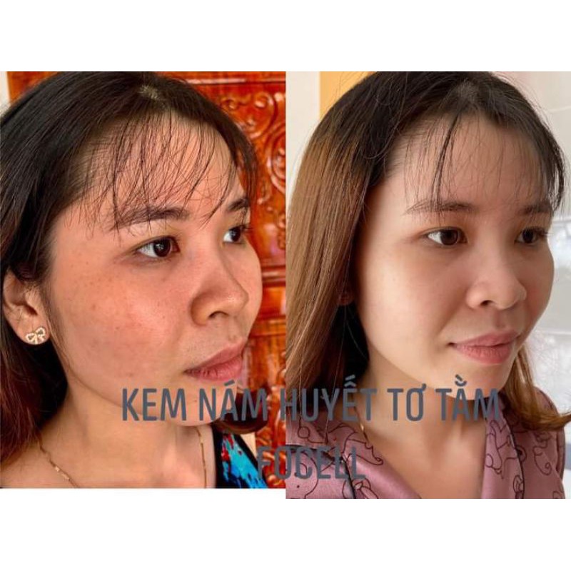 Kem Nám Huyết Tơ Tằm Focell Cream tặng kèm Serum C