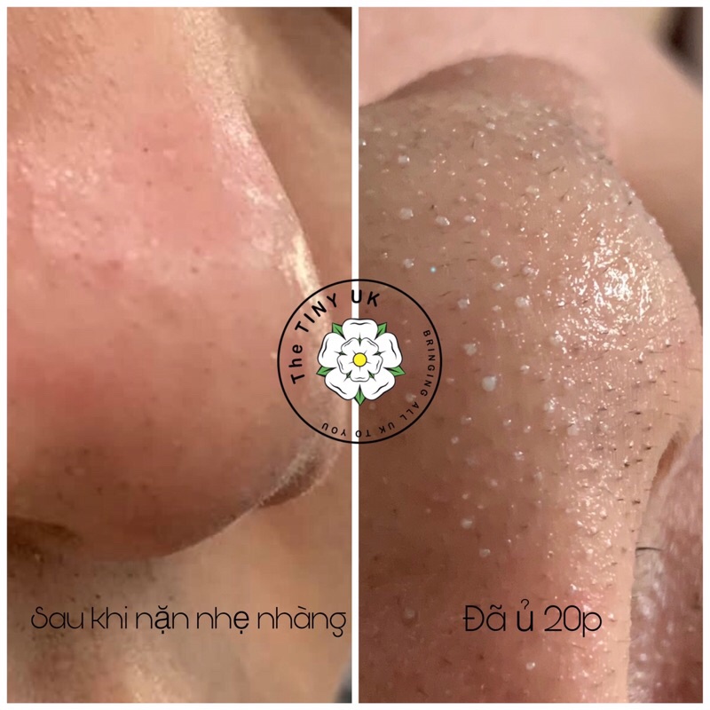 Ủ mụn Medipeel 100ml | BigBuy360 - bigbuy360.vn