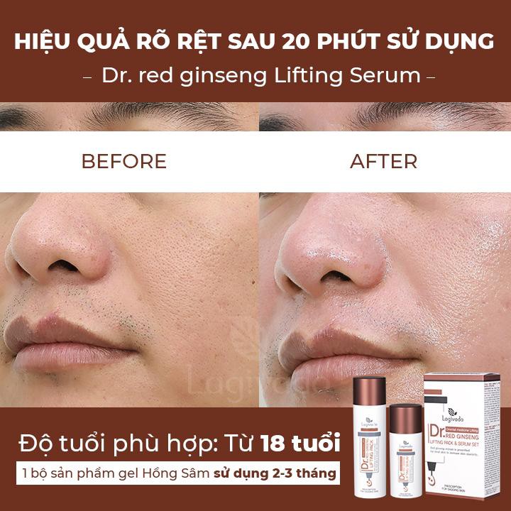 Gel mặt nạ hồng sâm Hàn Quốc giảm mụn đầu đen, nâng cơ, se khít lỗ chân lông Lagivado Dr. Red Ginseng Lifting Pack 50 ml