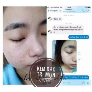 KEM TRỊ MỤN CC WHITE