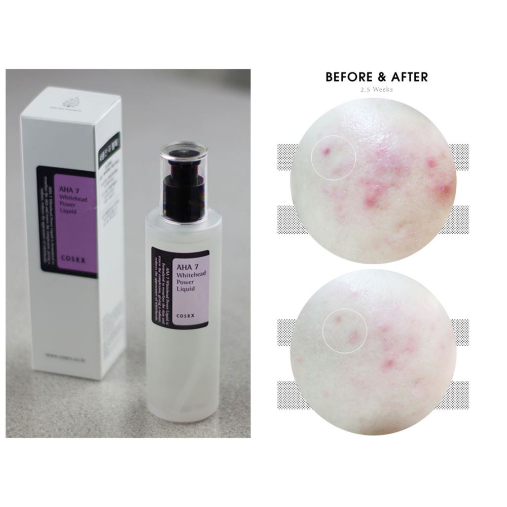 Nước hoa hồng COSRX Chứa AHA/BHA Clarifying Treatment Toner