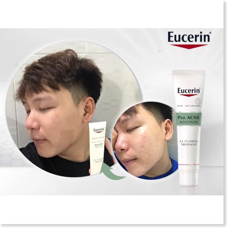 Tinh Chất Giảm Mụn, Mờ vết Thâm Eucerin Acne-Oil Control Pro Acne Solution A.I Clearing Treatment 40ml