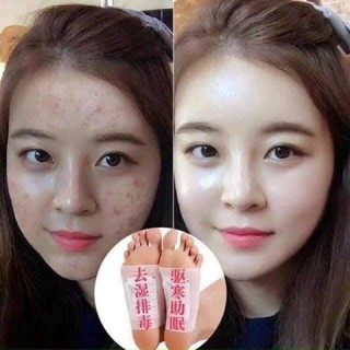 Hộp 50 miếng dán ngải cứu thải độc