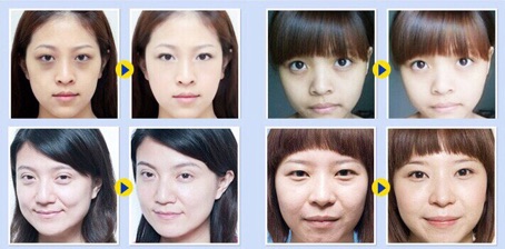 Mặt nạ mắt Collagen crystal eye