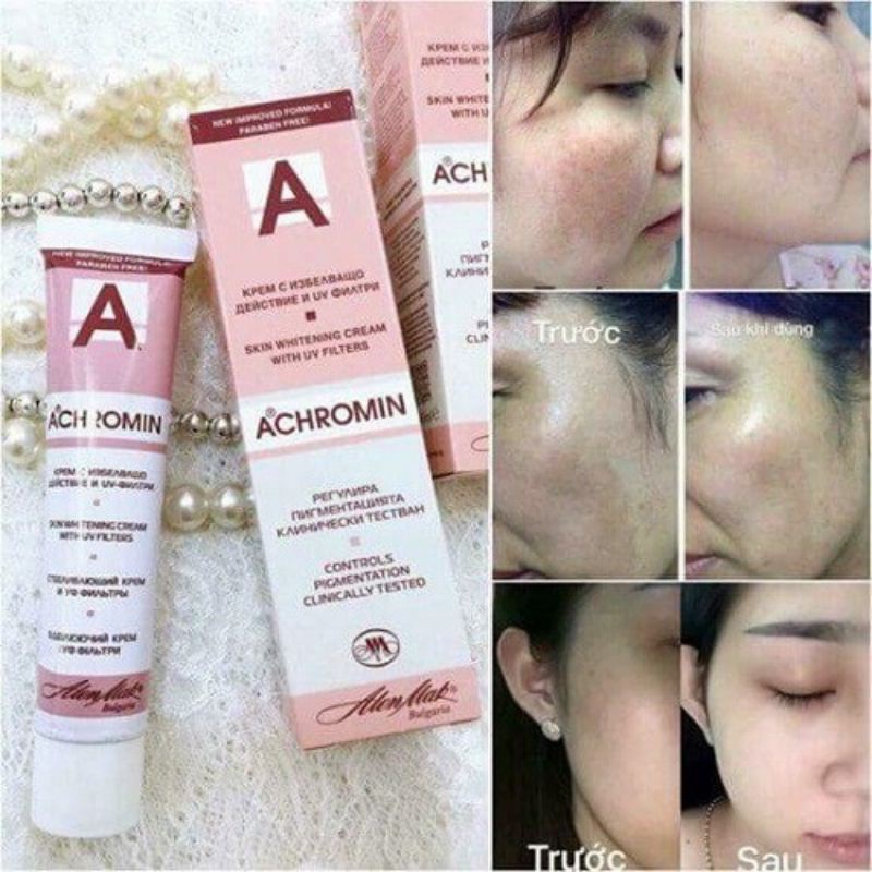 Kem nám Achromin _ Ken Nám A Nga giảm nám và tàn nhang