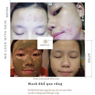 COMBO LEMONMASK KHỔ QUA RỪNG ( MUA 1 TẶNG 3 )